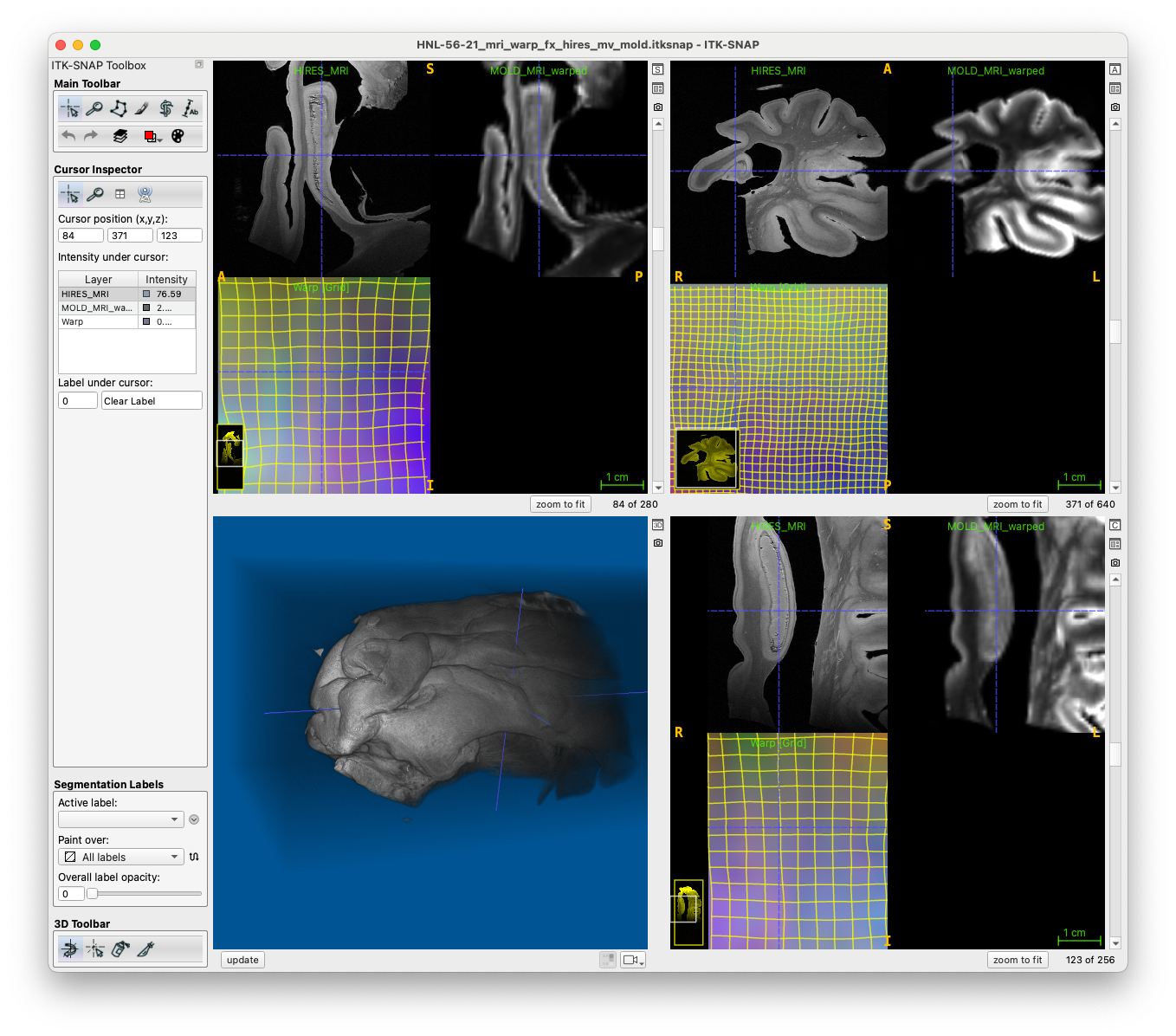 _images/example_process_mri_result_workspace.png