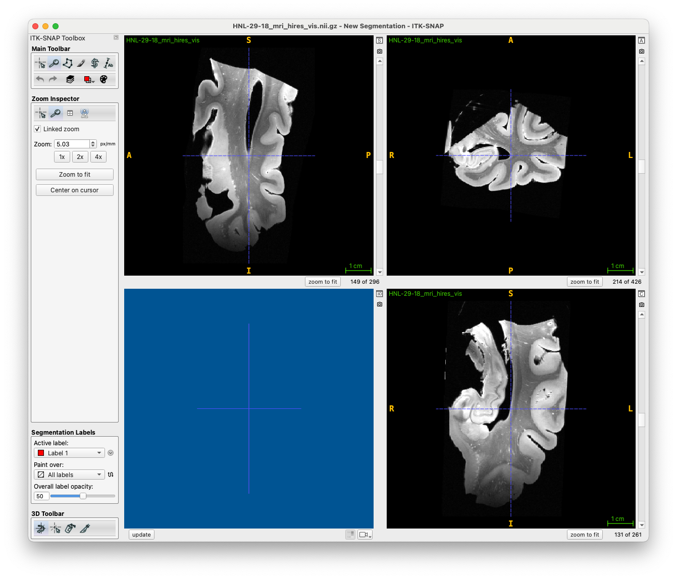 MRI oriented for visualization