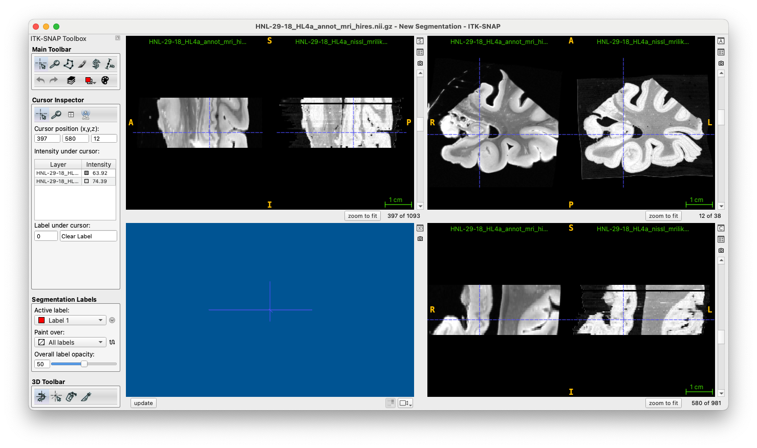 An example of a 3D recon in ITK-SNAP