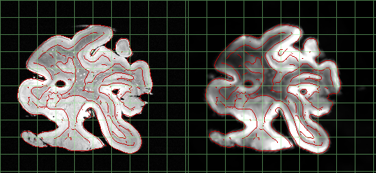 _images/qc_mri_hires_to_mold.png